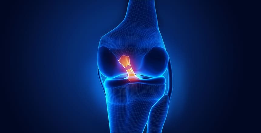 ACL Physiotherapy Sydney